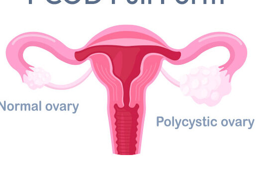 Natural Ways to Manage Menopause 3 women’s healthcare