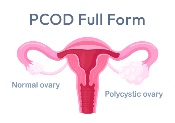 fix irregular periods 