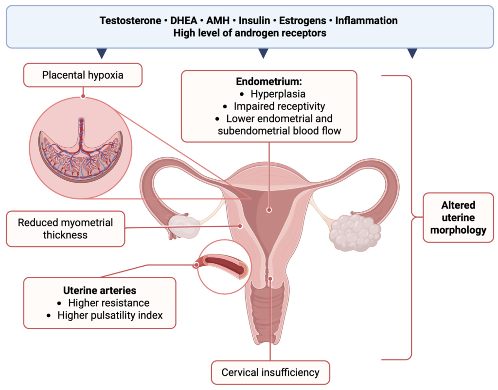 Understanding PCOS vs. Thyroid Disorder 2 PCOS vs. Thyroid Disorder
