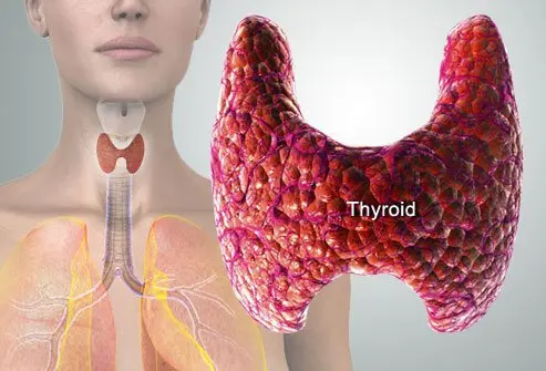 Understanding PCOS vs. Thyroid Disorder 1 Difference Between PCOS and a Thyroid Disorder